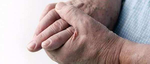 Остеоартроз межфаланговых суставов кистей рук